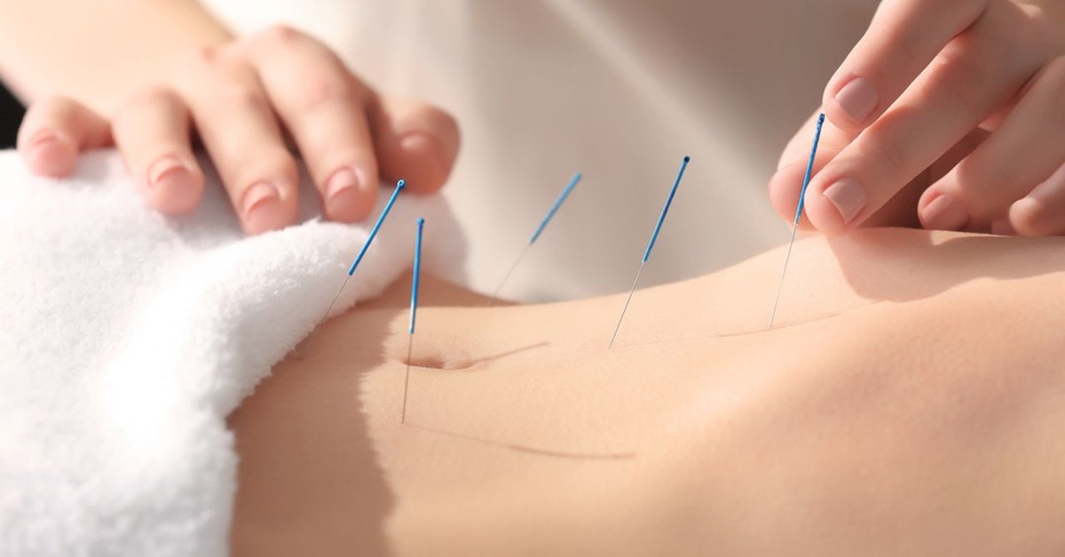 Acupuncture in Saigon: Top places in quality